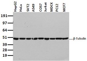 beta IV Tubulin (TUBB4A) Mouse Monoclonal Antibody [Clone ID: OTI5C1]βIV 微管蛋白 （TUBB4A） 小鼠单克隆抗体
