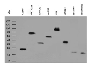 Clone OTI2B5, Anti-His mouse monoclonal antibody克隆OTI2B5，抗小鼠单克隆抗体