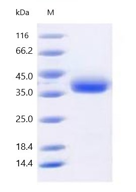 SARS-CoV-2 (BA.4/BA.5/BA.5.2) Spike RBD Protein (His&amp;AVI Tag)，Biotinylated(NBS4592-20ug)