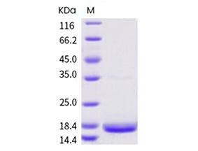 Recombinant SARS-CoV-2 (2019-nCoV) NSP10 Protein（ NBS4598-100ug）